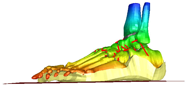 mesh of human foot - medial view