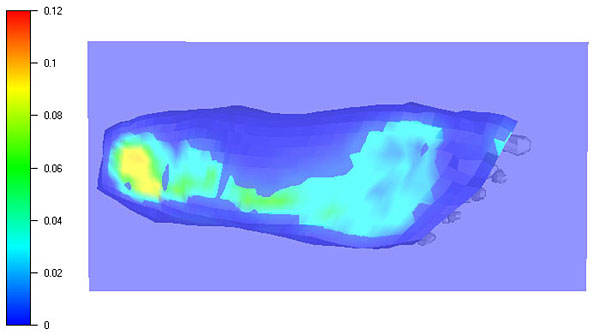 mesh of human foot - plantar pressure