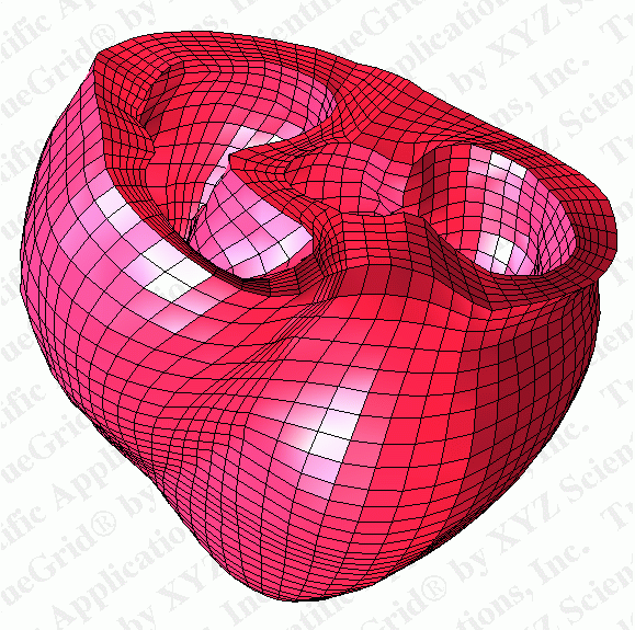 TrueGrid® Hexahedral Meshes of the Human Heart