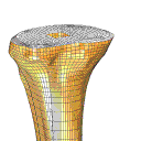 Tibia 1 with Implant