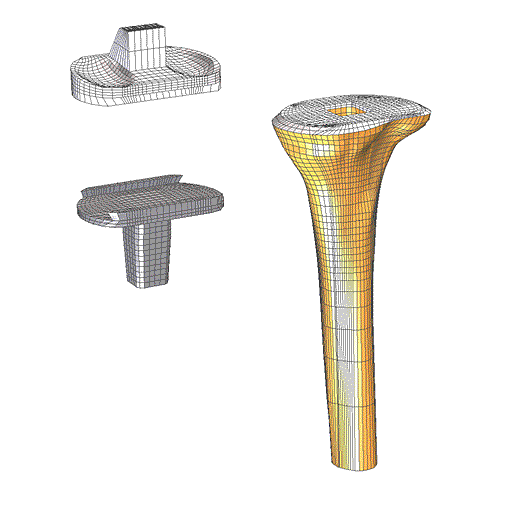 TrueGrid® Mesh of Upper Tibia 2 with Implants