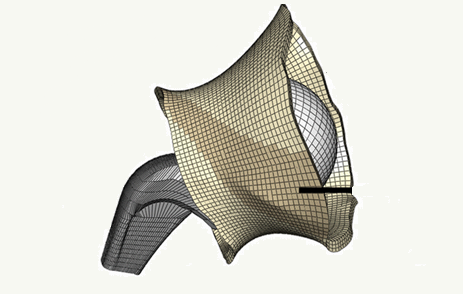 The Capsule's Contribution to Total Hip Construct Stability- A Finite Element Analysis