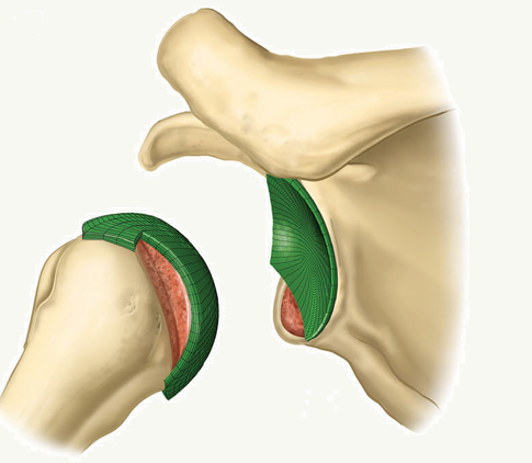 A Theoretical Model of the Effect of Bone Defects on Anterior Shoulder Instability