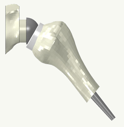 Mechanical trade-offs in changing centers of rotation for reverse shoulder arthroplasty design