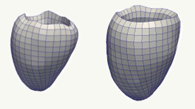 Abaqus/Standard-based quantification of human cardiac mechanical properties