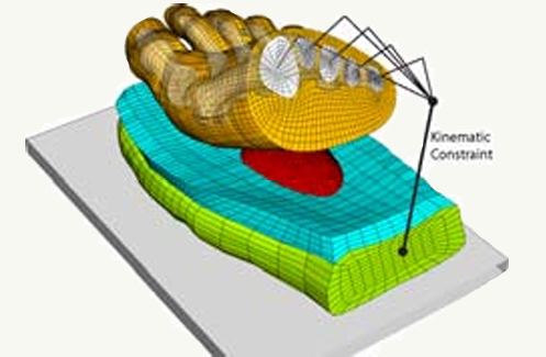 COMPUTATIONAL PREDICTION OF IN-SHOE PRESSURES WITH AND WITHOUT A METATARSAL PAD