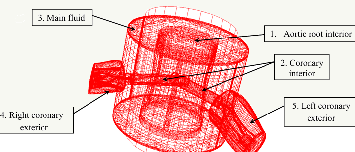 Fluid Structure Interaction and Hemodynamic Analysis of the Aortic Valve