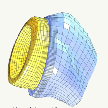 Effects of implant design variations on shoulder instability following reverse shoulder arthroplasty