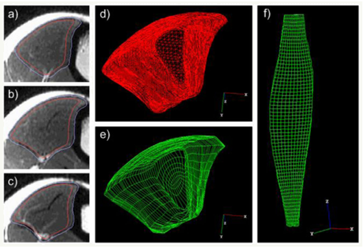Method for three-dimensional analysis of skeletal muscle strain